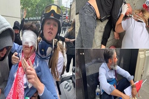 ۱۴ زخمی در درگیری پلیس با مردمِ پاریس
