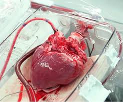 صدور مجوز پیوند قلب در خوزستان/ رشد ۳۰۰ درصدی اهدای عضو در استان