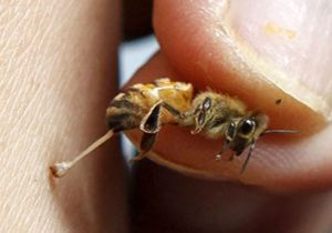 یک دانش آموز در ایذه به علت زنبور گزیدگی فوت کرد